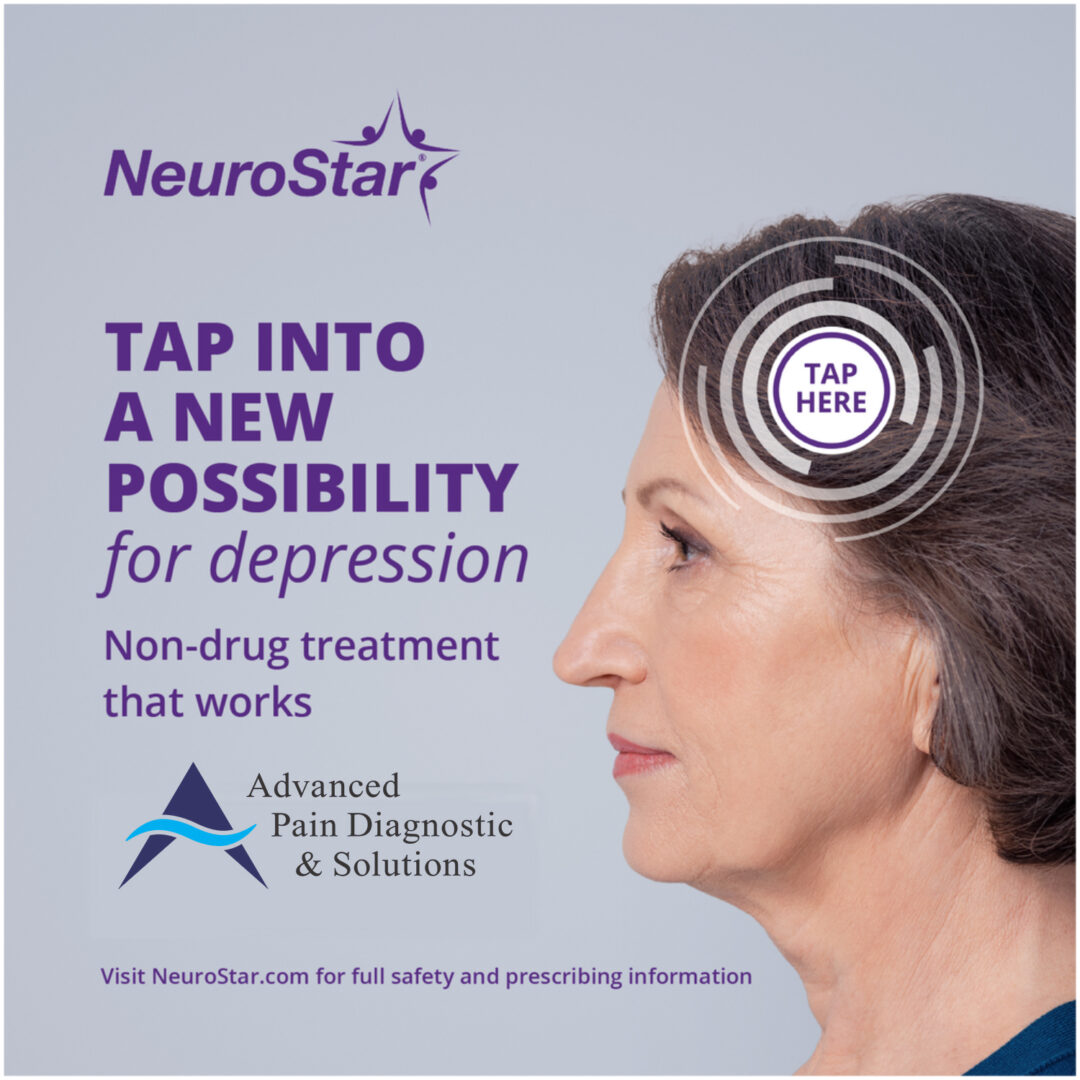 NeuroStar Non Drug Treatment for Depression Poster